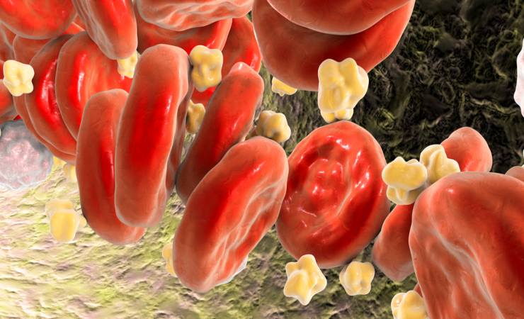 colesterolo sangue