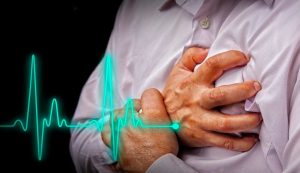 infarto cardiaco